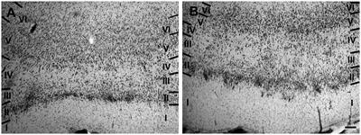 Distribution of calcium-binding proteins immunoreactivity in the bottlenose dolphin entorhinal cortex